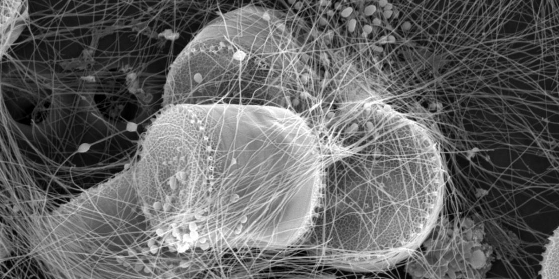 NOAAFisheriesWestCoast_Flickr_260315